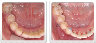 Case 01