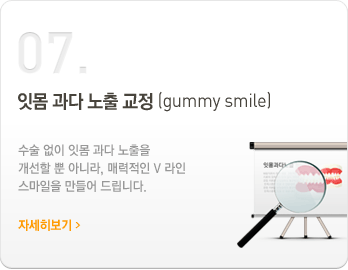 7.잇몸 과다 노출 교정(gummy smile)