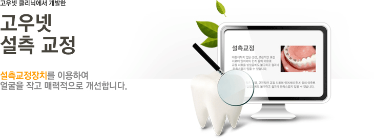 고우넷 교정 소개 - 고우넷 설측교정(긴 얼굴, 잇몸 돌출, 무턱, 주걱털, 잇몸 과다 노출 등을 짧은 기간 수술 없이 얼굴이 작아지고 매력적으로 바뀝니다.)