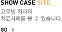 SHOW CASE SITE 고우넷 치과의 치료사례를 볼 수 있습니다.